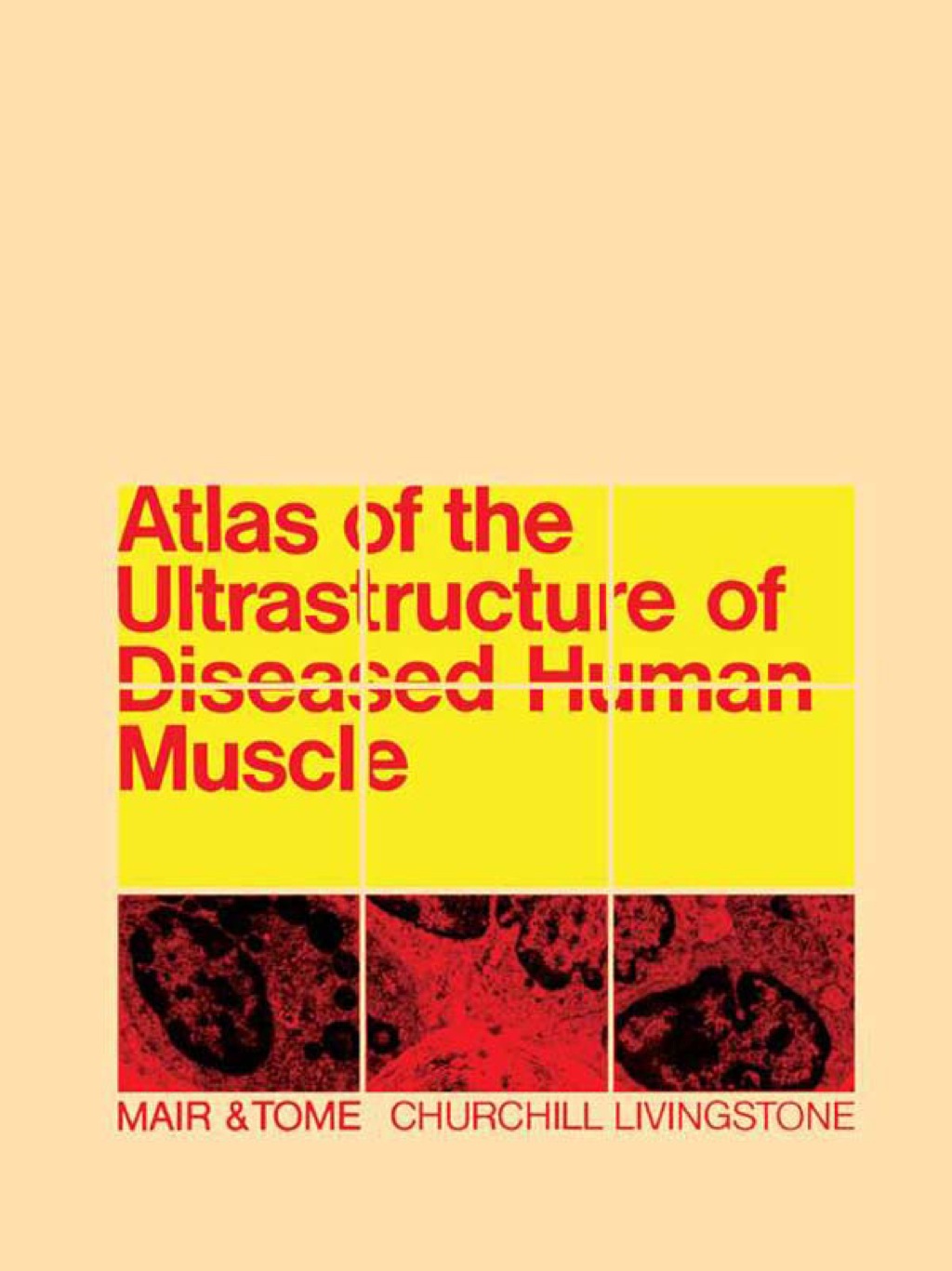 Atlas of the Ultrastructure of Diseased Human Muscle 