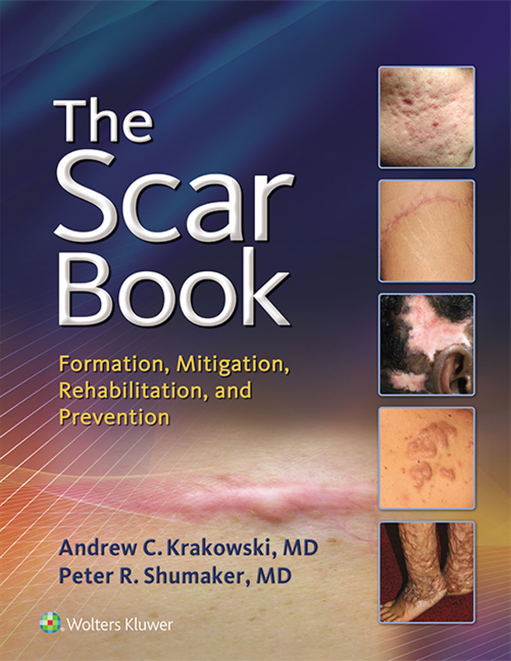 The Scar Book Formation, Mitigation, Rehabilitation and Prevention 