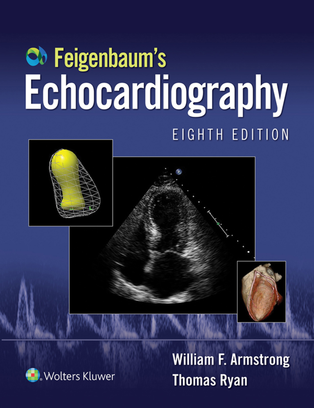 Feigenbaum's Echocardiography: Ebook without Multimedia 8th Edition