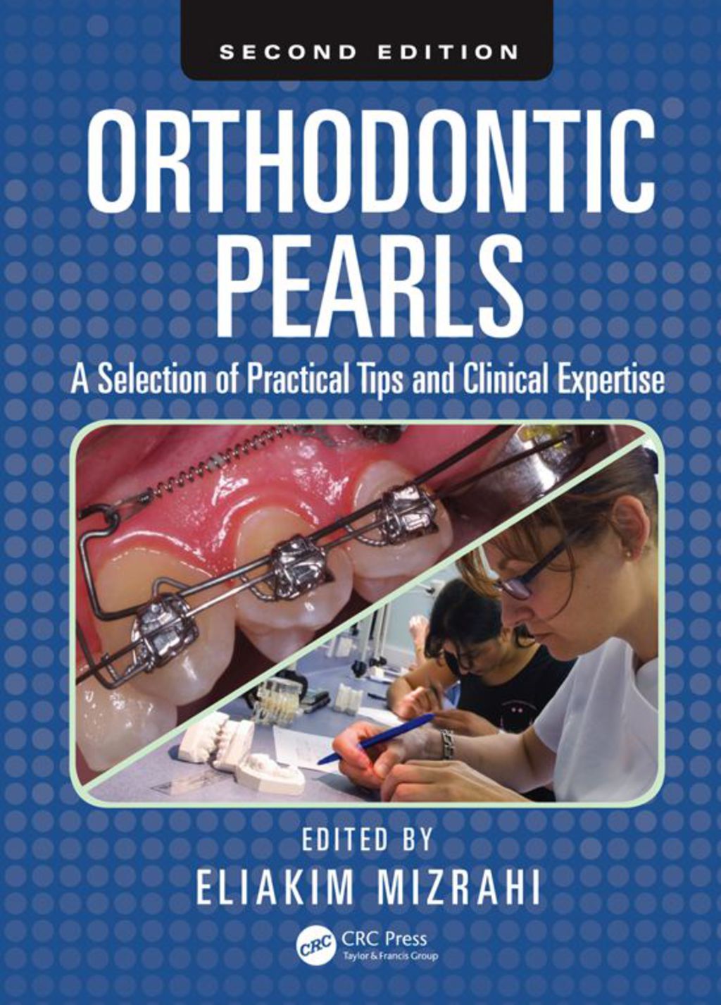 Orthodontic Pearls A Selection of Practical Tips and Clinical Expertise, Second Edition 2nd Edition