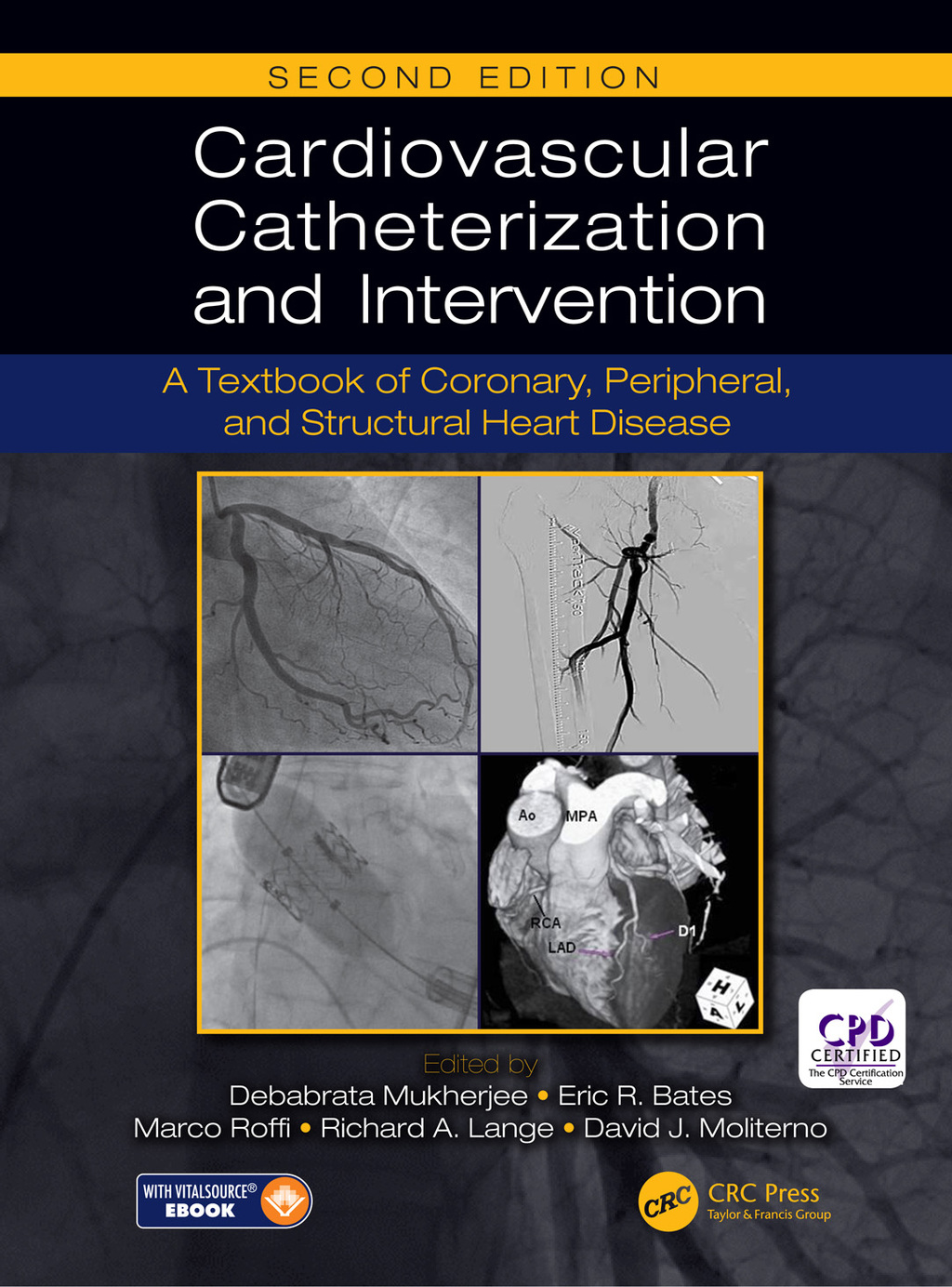 Cardiovascular Catheterization and Intervention A Textbook of Coronary, Peripheral, and Structural Heart Disease, Second Edition 2nd Edition