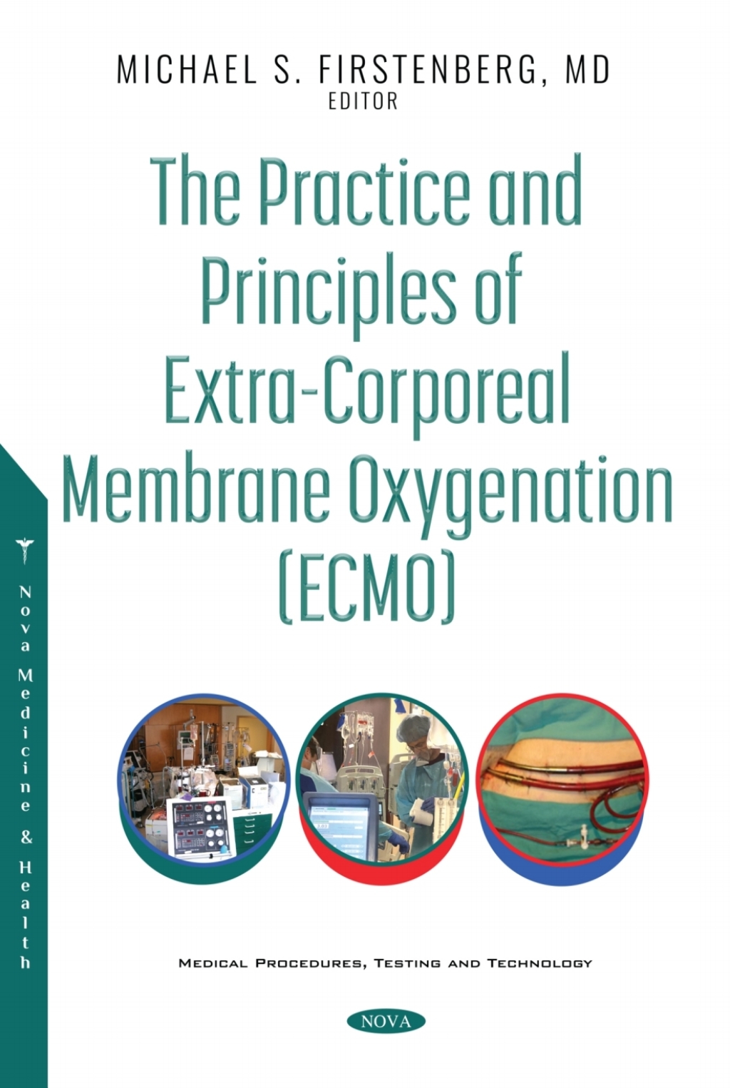 The Practice and Principles of Extra-Corporeal Membrane Oxygenation (ECMO) 