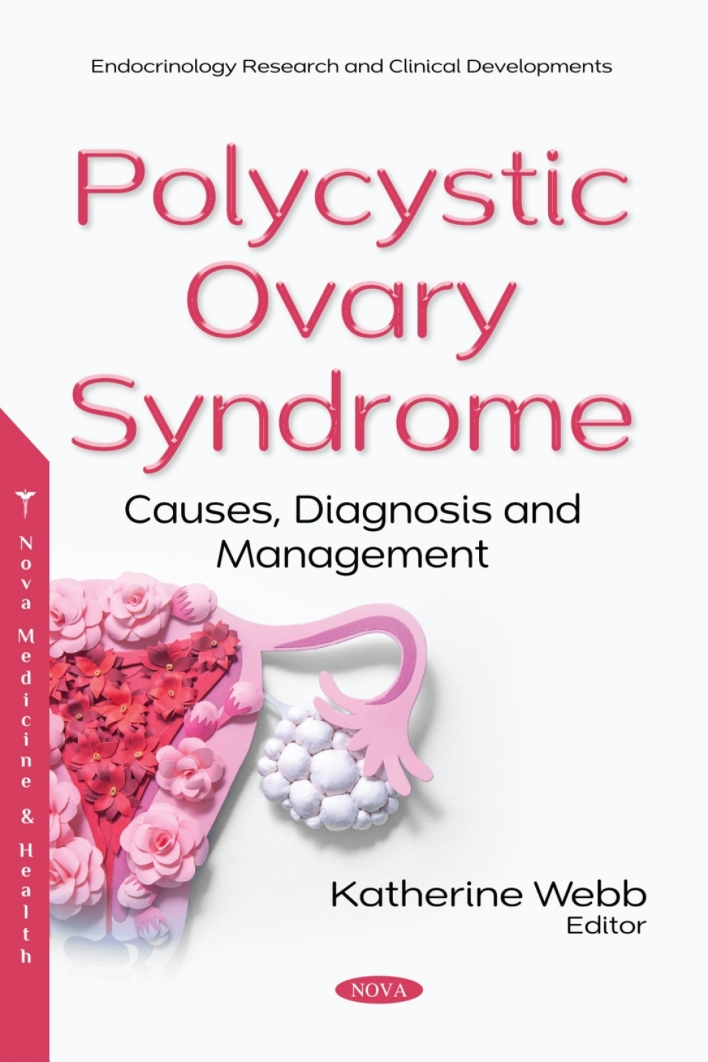 Polycystic Ovary Syndrome: Causes, Diagnosis and Management 