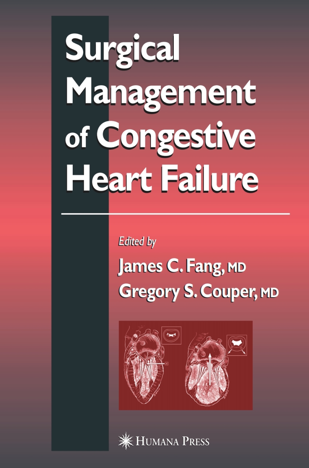 Surgical Management of Congestive Heart Failure 1st Edition