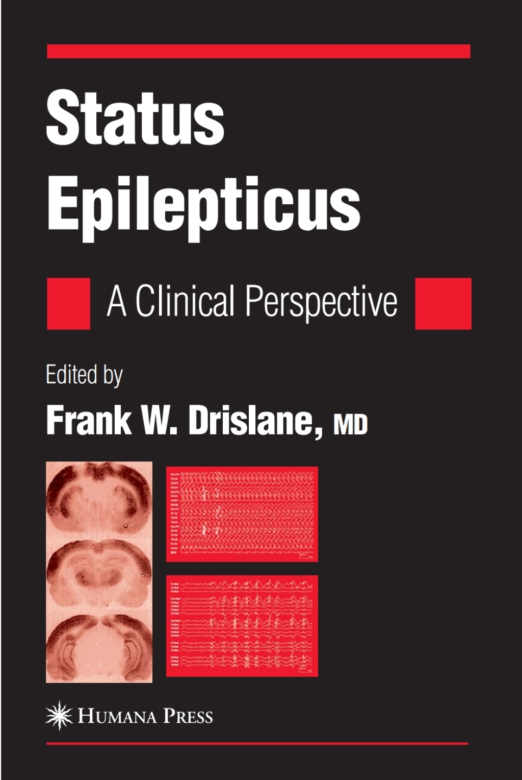 Status Epilepticus A Clinical Perspective 1st Edition