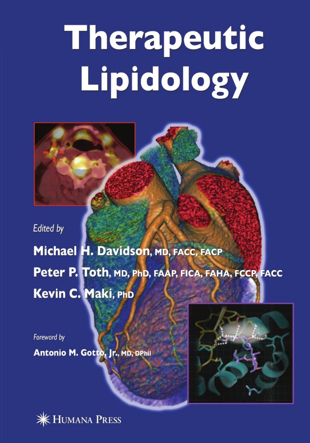 Therapeutic Lipidology 