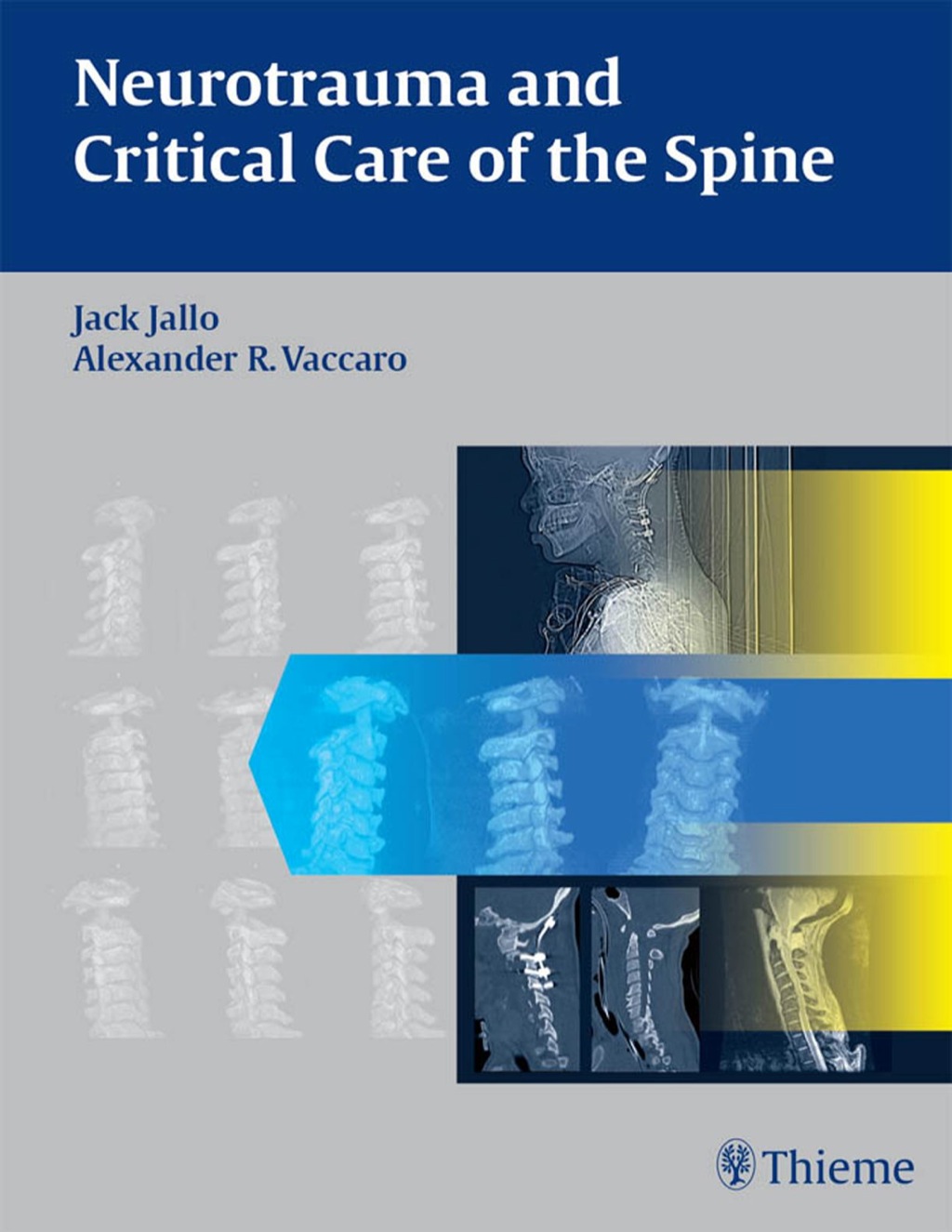Neurotrauma and Critical Care of the Spine 1st Edition