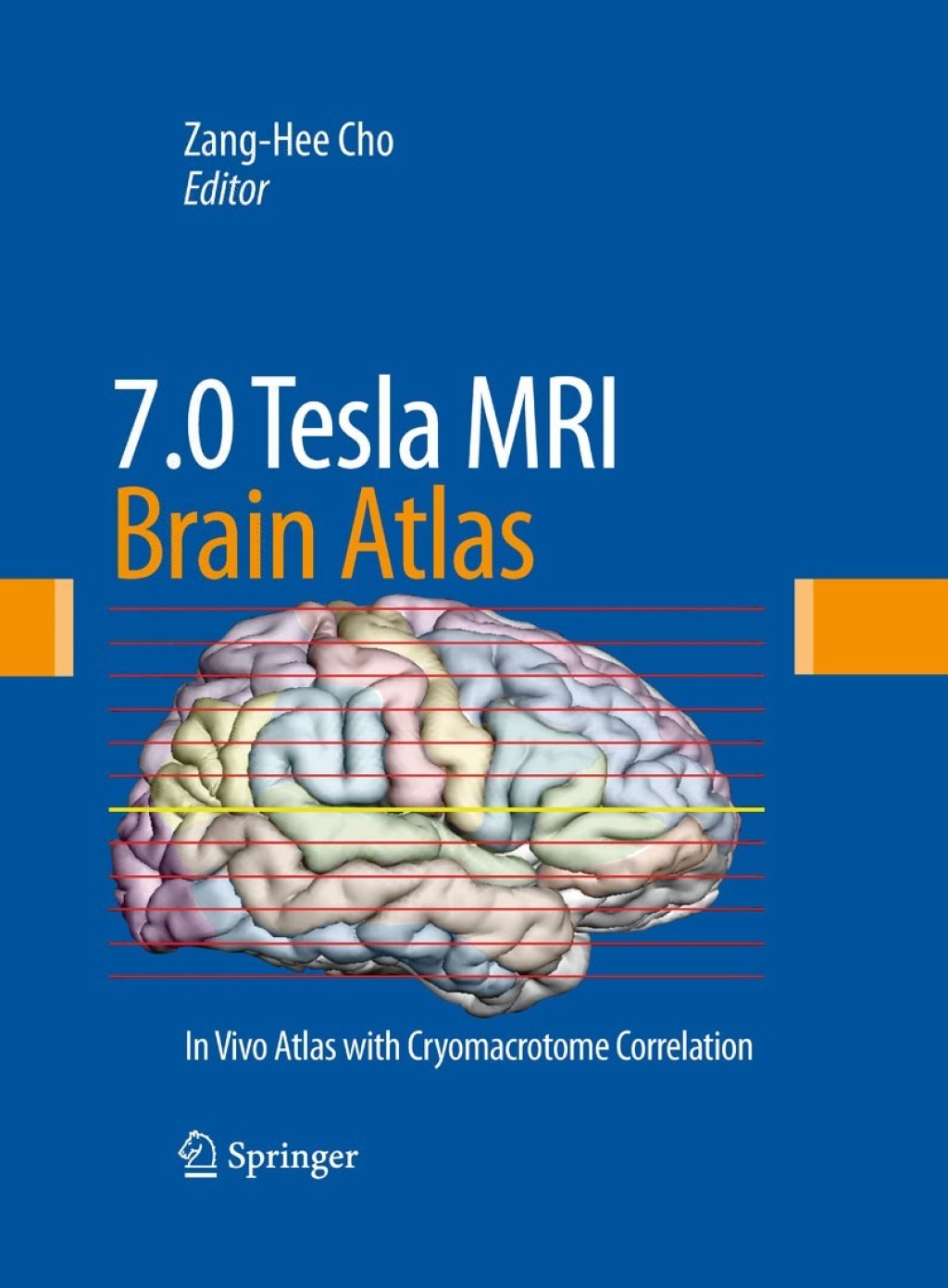 7.0 Tesla MRI Brain Atlas In Vivo Atlas with Cryomacrotome Correlation 2nd Edition