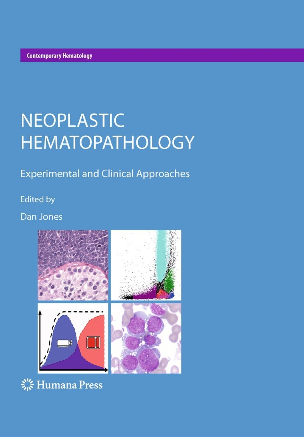 Neoplastic Hematopathology Experimental and Clinical Approaches 1st Edition