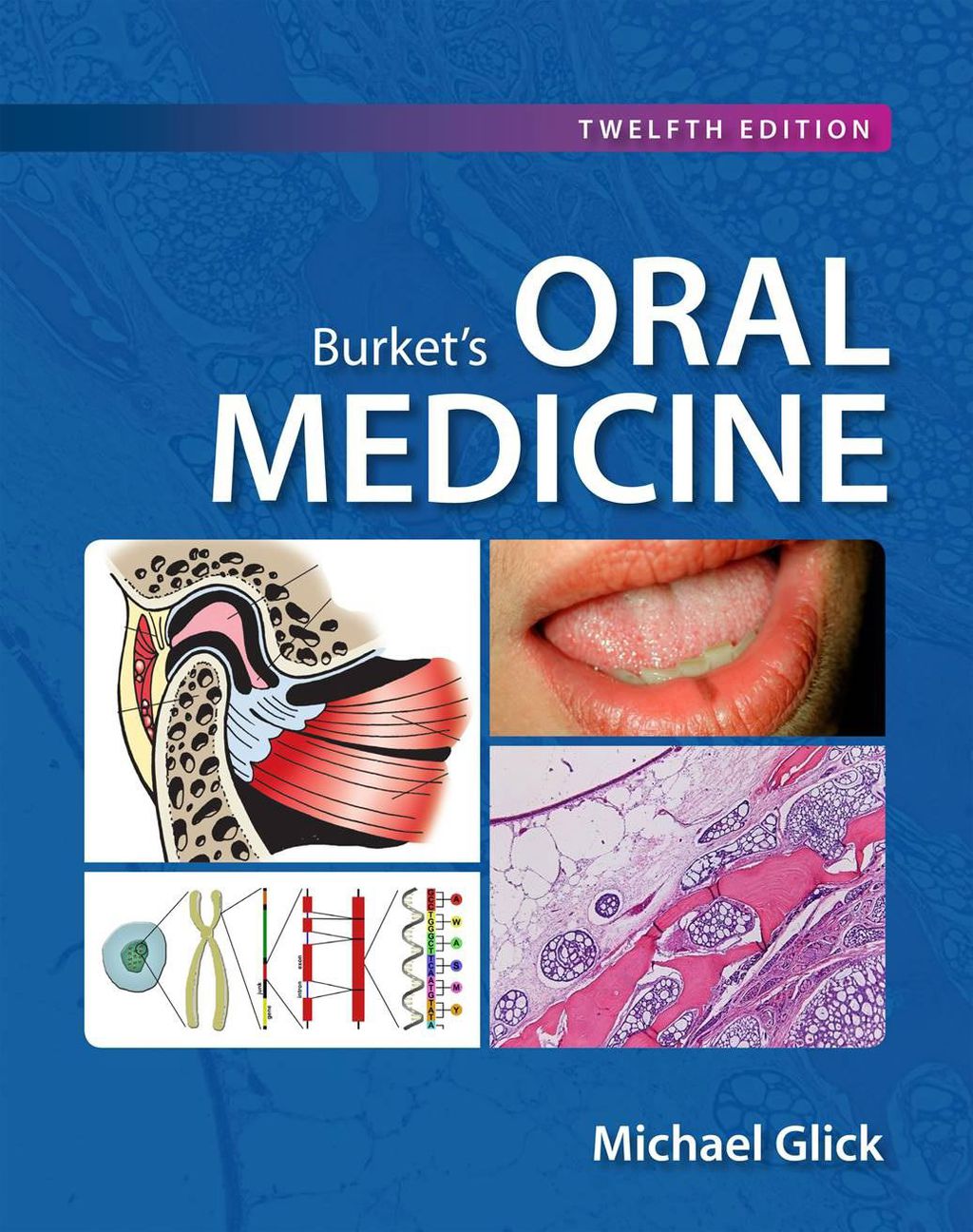 Burket's Oral Medicine 12th Edition