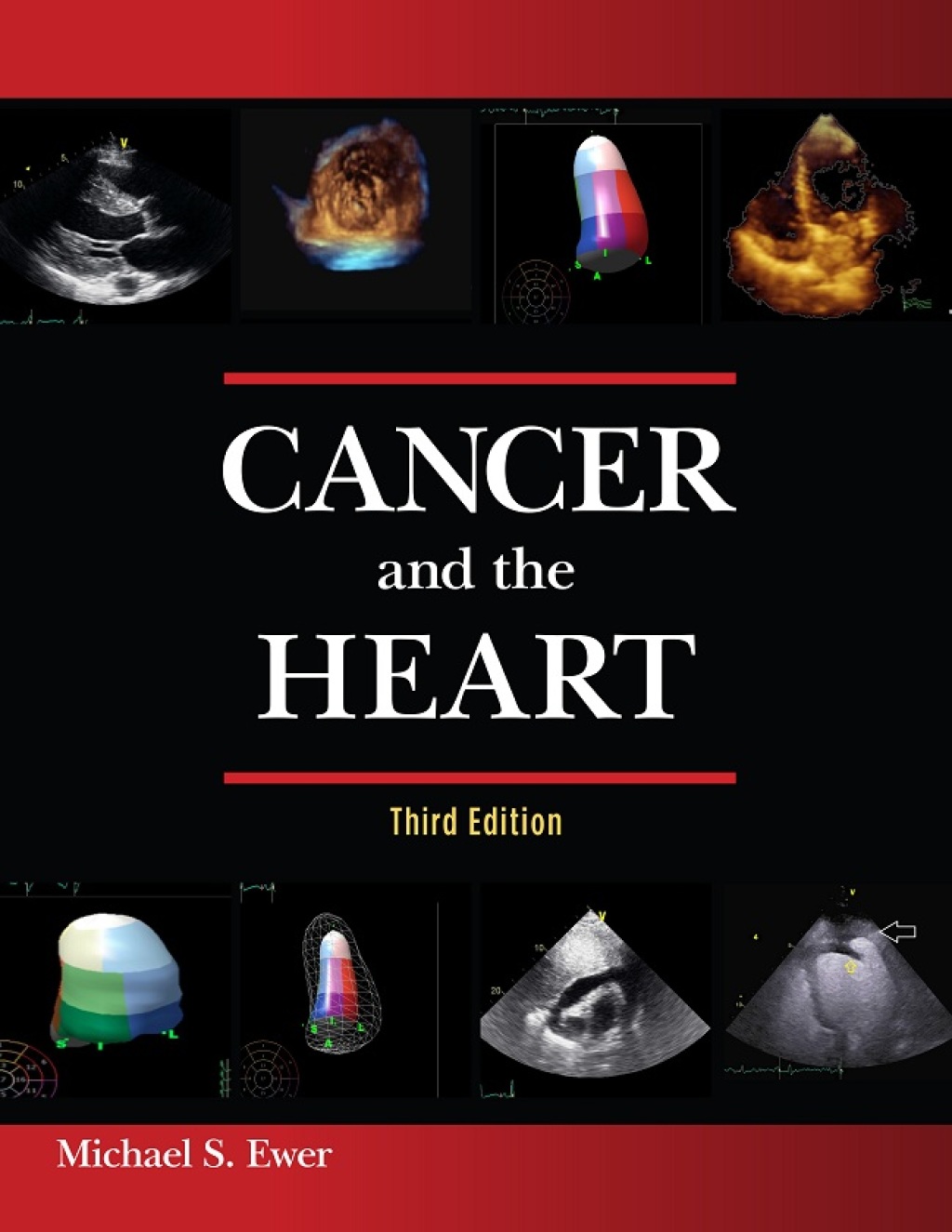 Cancer and the Heart 3rd Edition