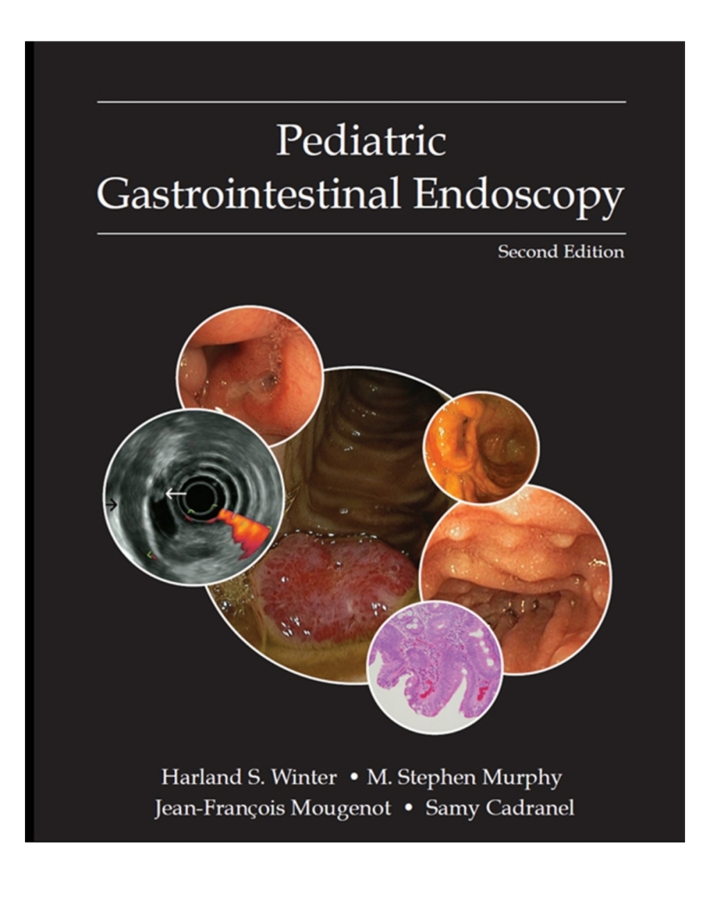 Pediatric Gastrointestinal Endoscopy 2nd Edition