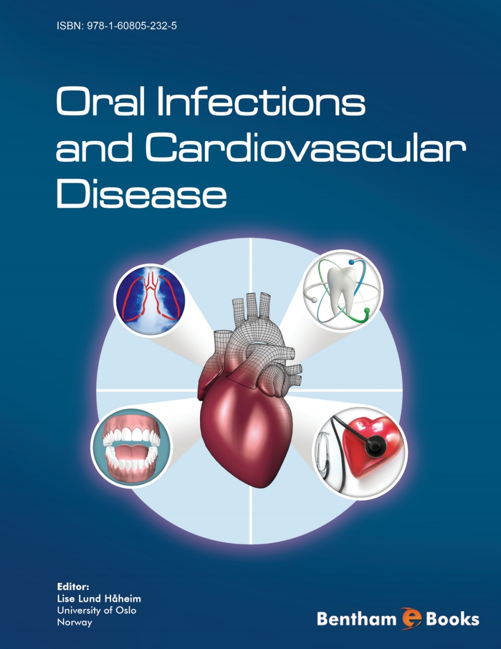 Oral Infections and Cardiovascular Disease 1st Edition