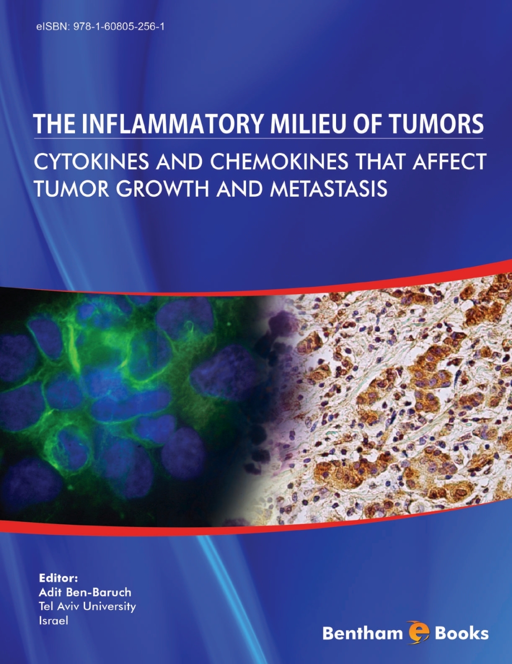 The Inflammatory Milieu of Tumors: Cytokines and Chemokines that Affect Tumor Growth and Metastasis 1st Edition