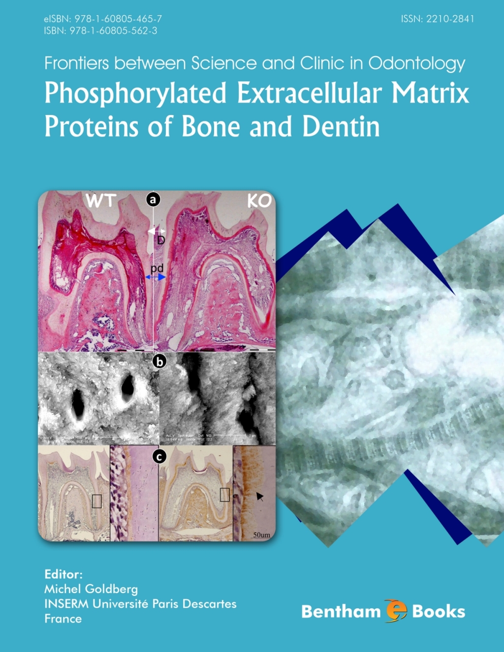 Phosphorylated Extracellular Matrix Proteins of Bone and Dentin 1st Edition