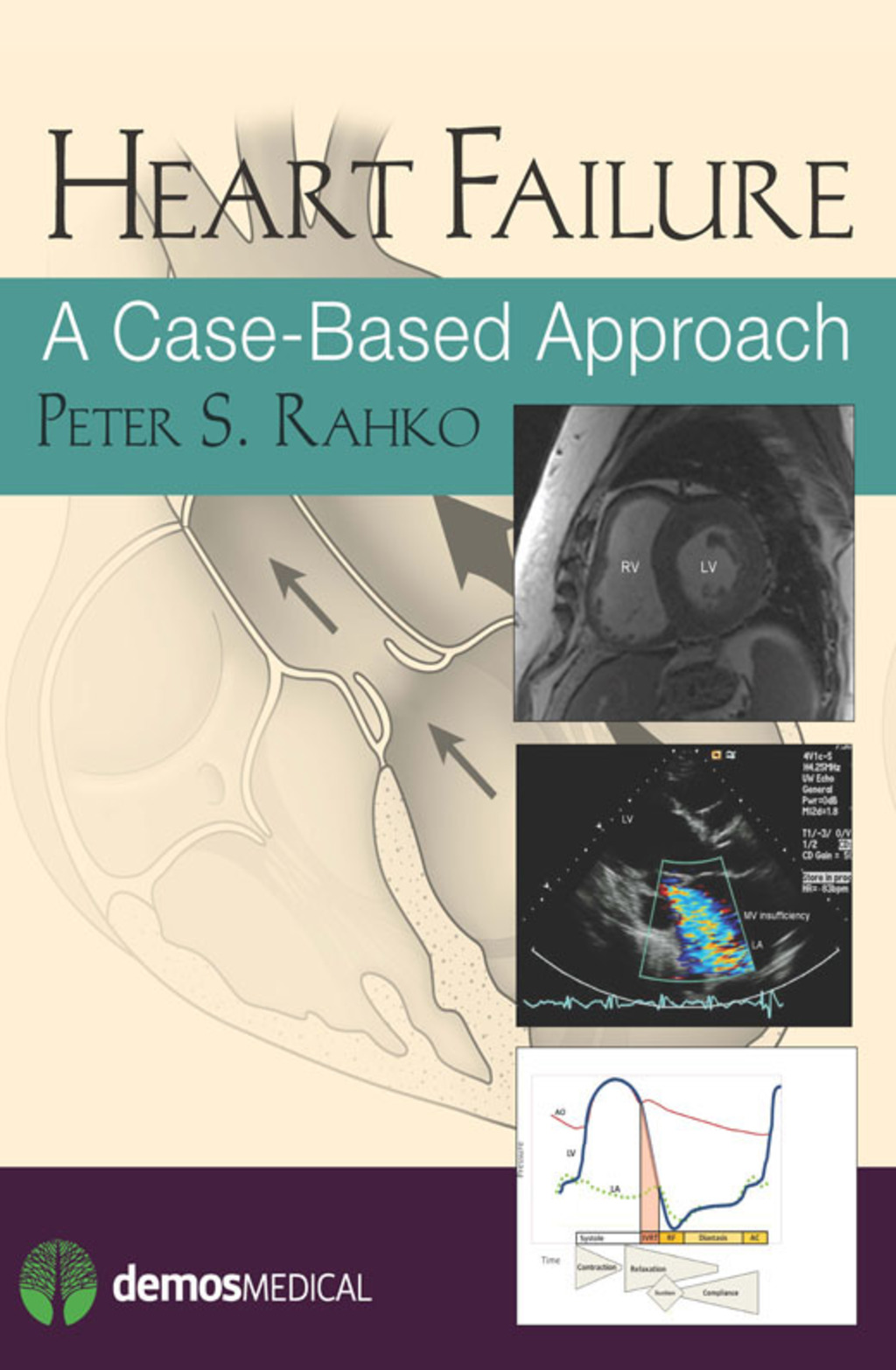 Heart Failure A Case-Based Approach 1st Edition