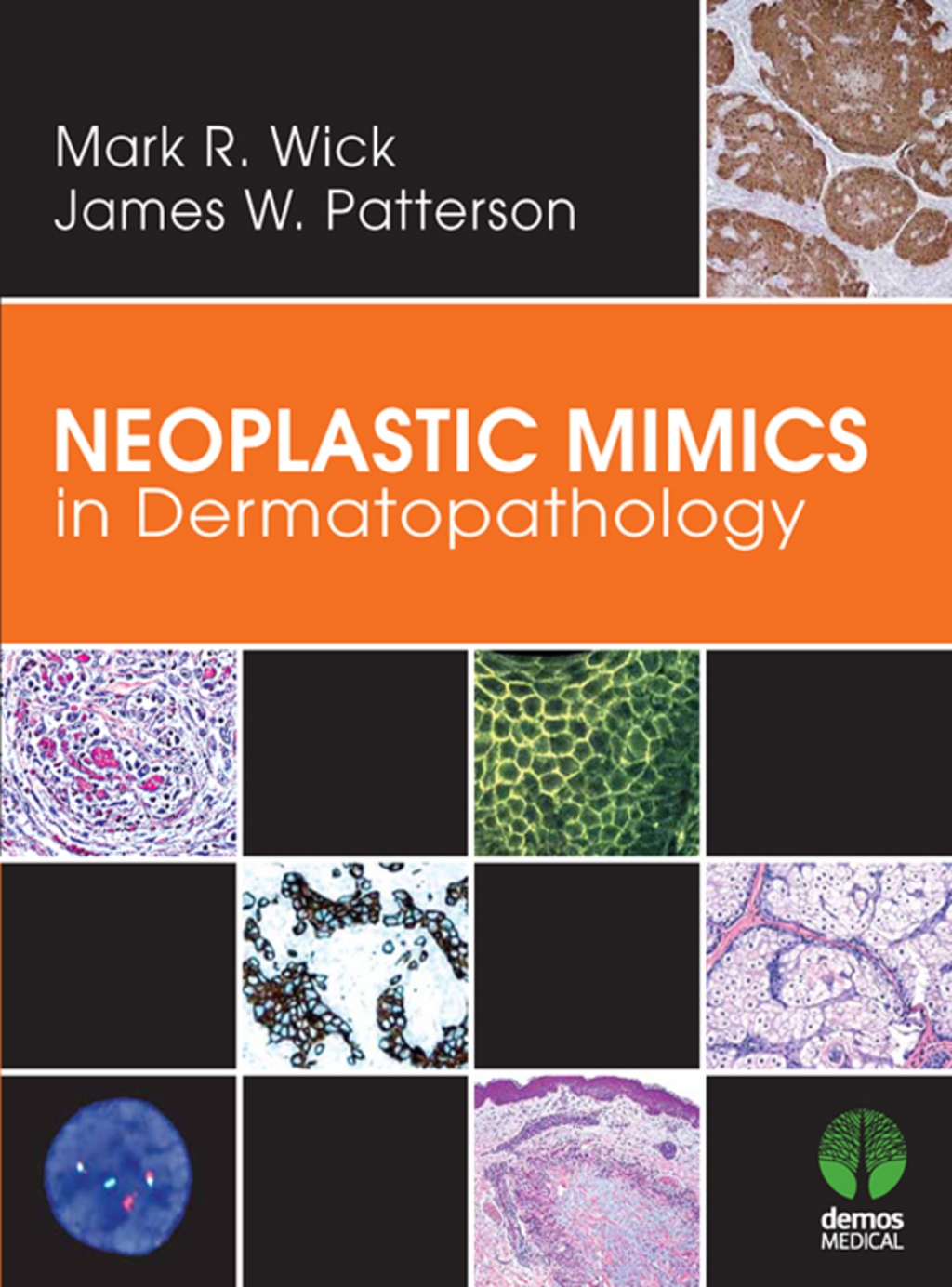 Neoplastic Mimics in Dermatopathology 1st Edition