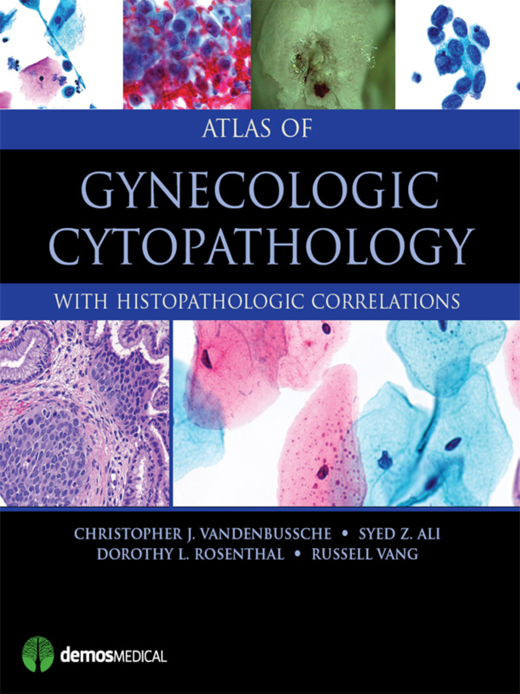 Atlas of Gynecologic Cytopathology with Histopathologic Correlations 1st Edition