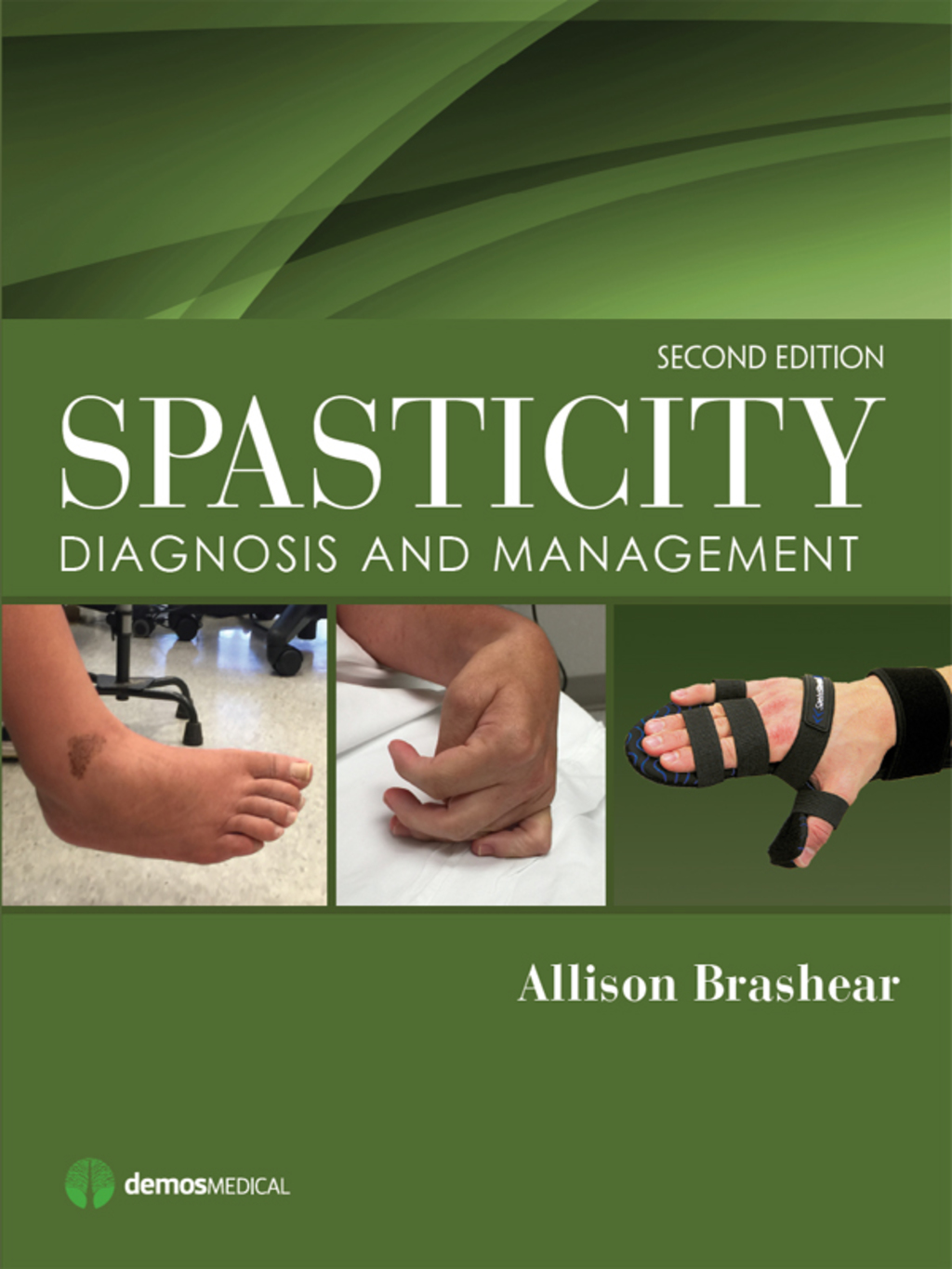 Spasticity Diagnosis and Management 2nd Edition