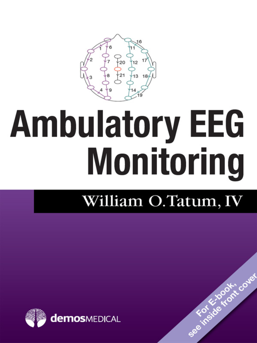 Ambulatory EEG Monitoring 1st Edition