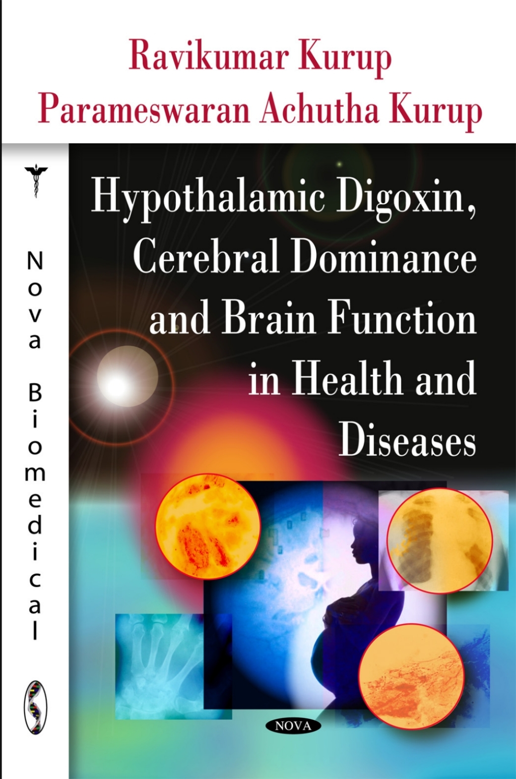 Hypothalamic Digoxin, Cerebral Dominance and Brain Function in Health and Diseases 