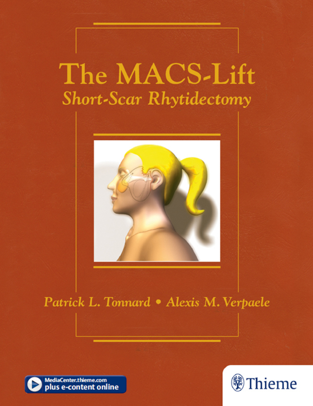 The MACS-Lift Short-Scar Rhytidectomy 1st Edition