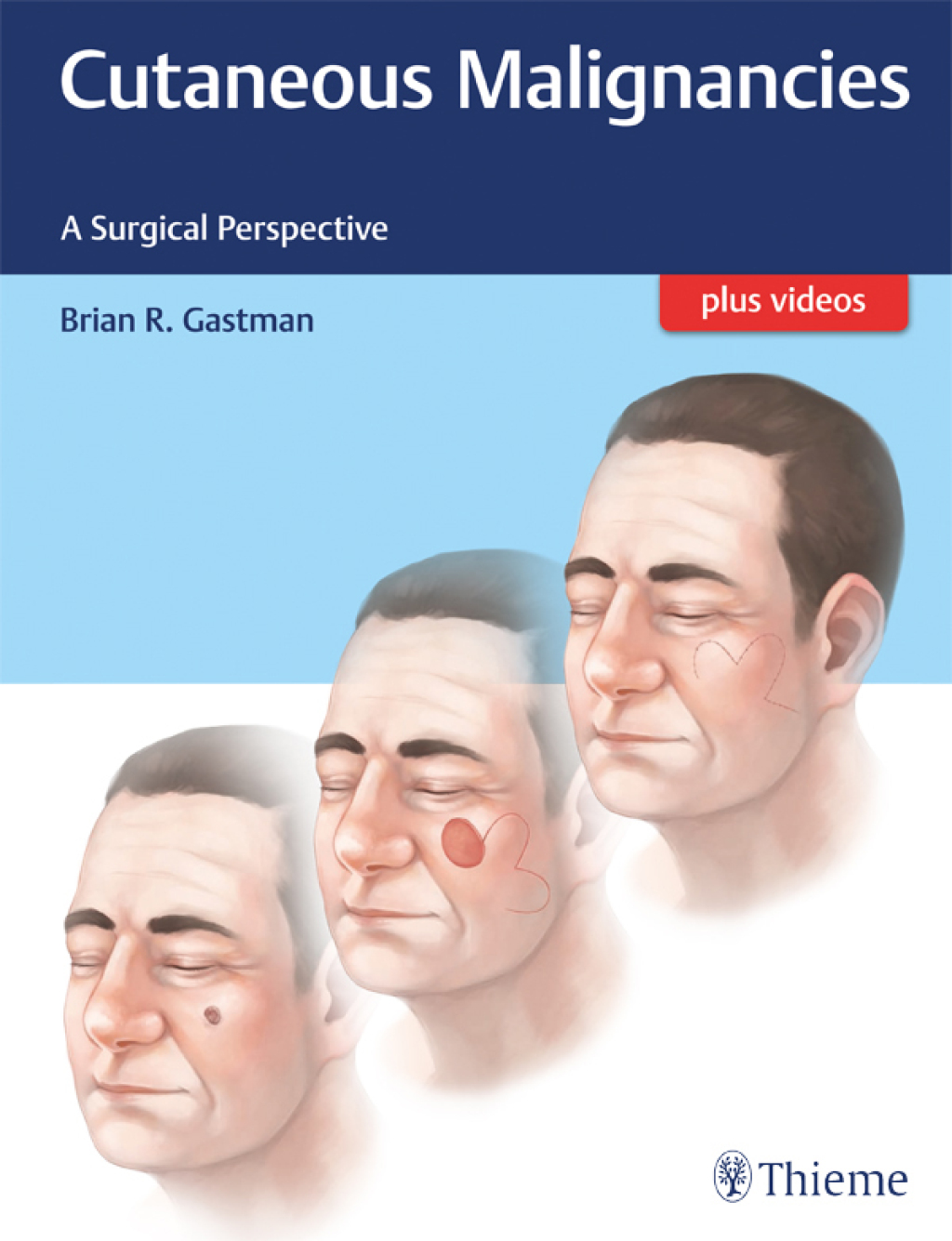 Cutaneous Malignancies A Surgical Perspective 1st Edition
