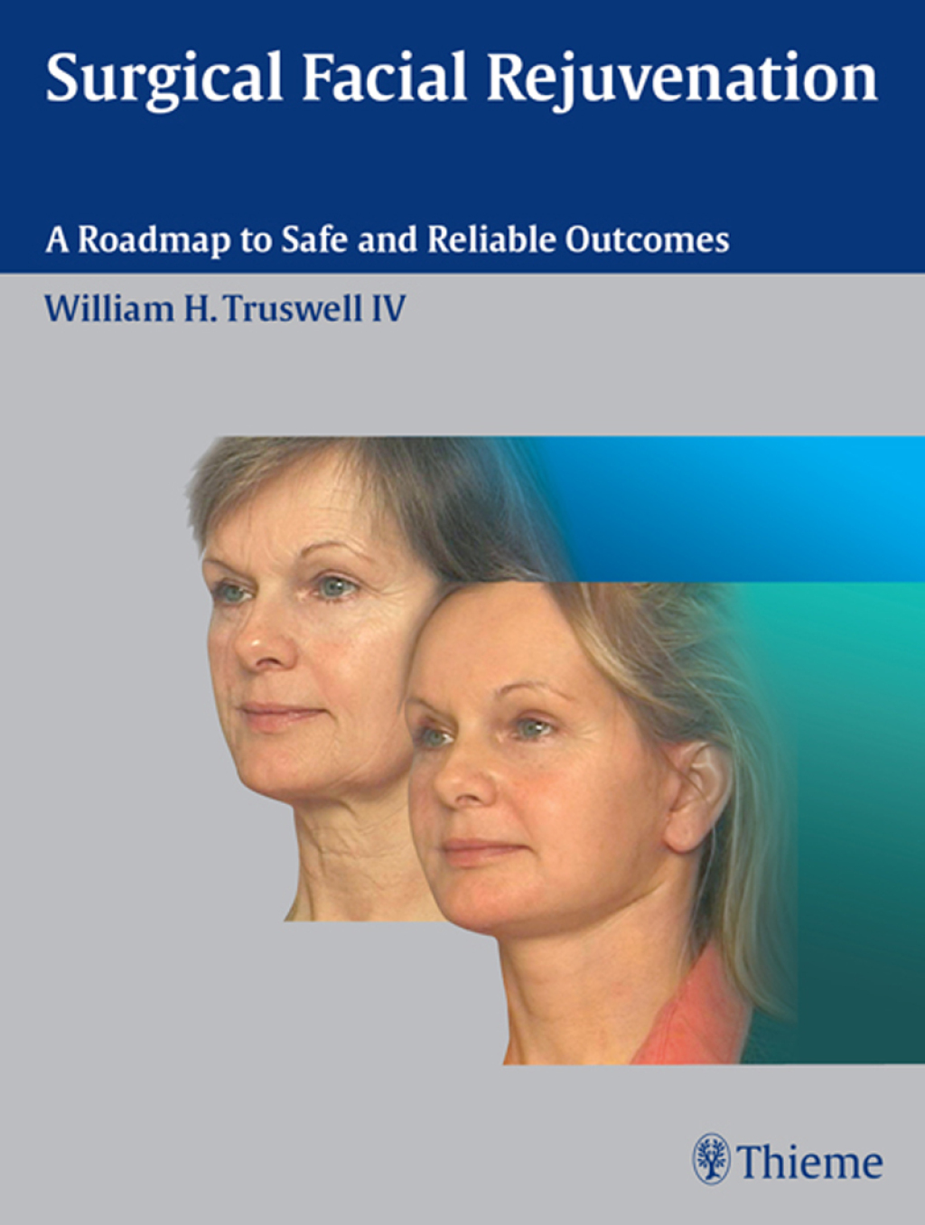 Surgical Facial Rejuvenation A Roadmap to Safe and Reliable Outcomes 1st Edition
