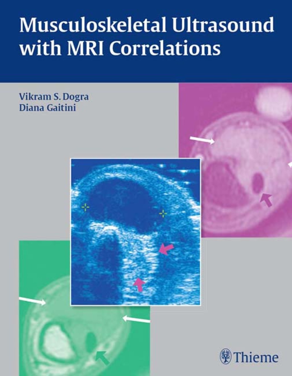Musculoskeletal Ultrasound with MRI Correlations 1st Edition