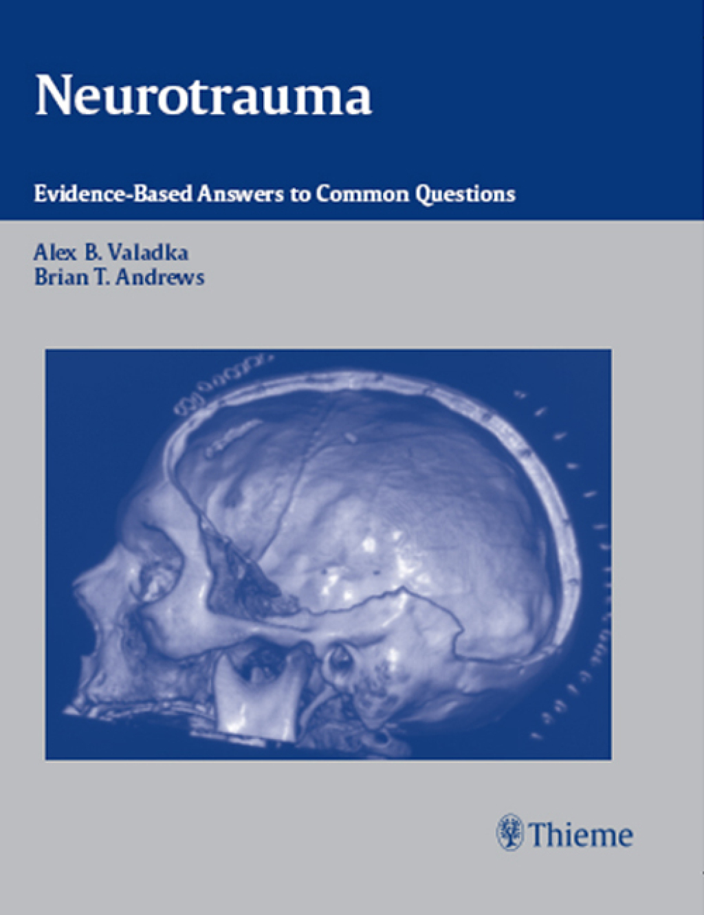 Neurotrauma Evidence-Based Answers to Common Questions 1st Edition