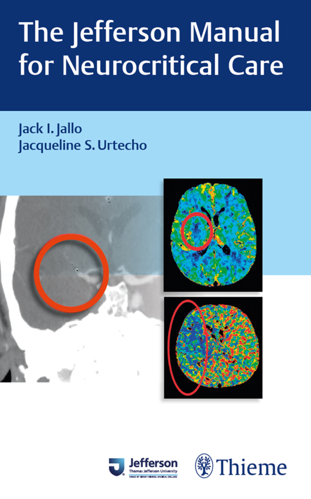 The Jefferson Manual for Neurocritical Care 1st Edition