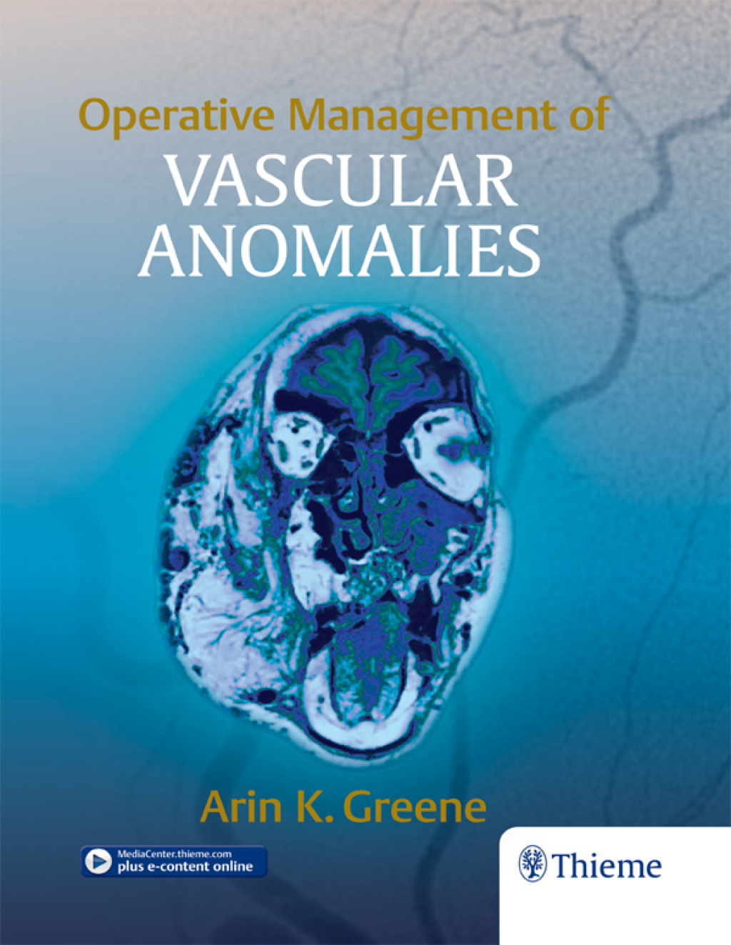 Operative Management of Vascular Anomalies 1st Edition