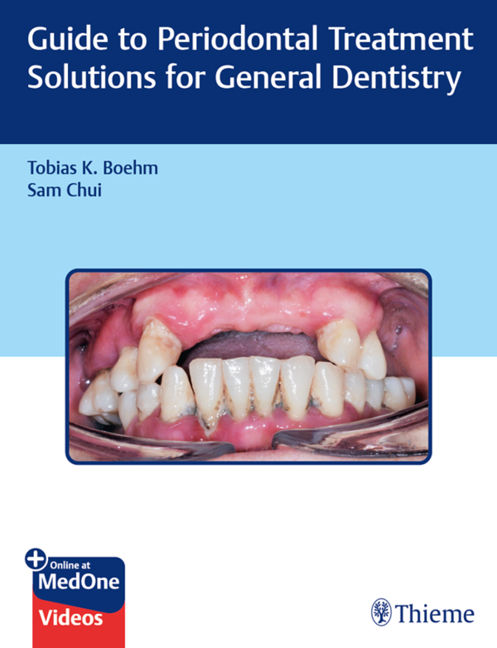 Guide to Periodontal Treatment Solutions for General Dentistry 1st Edition