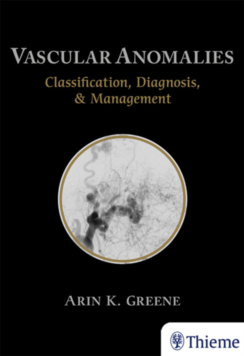 Vascular Anomalies Classification, Diagnosis, and Management 1st Edition