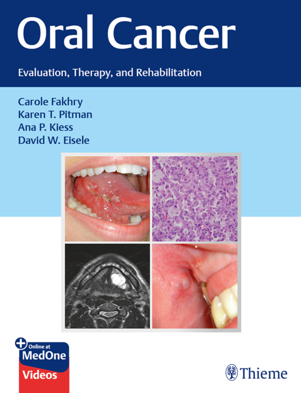 Oral Cancer Evaluation, Therapy, and Rehabilitation 1st Edition