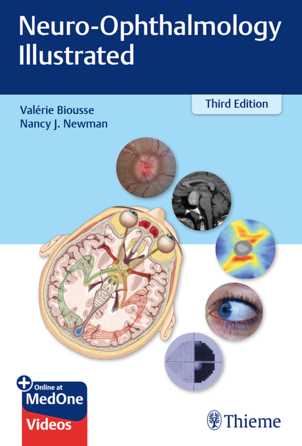 Neuro-Ophthalmology Illustrated 3rd Edition