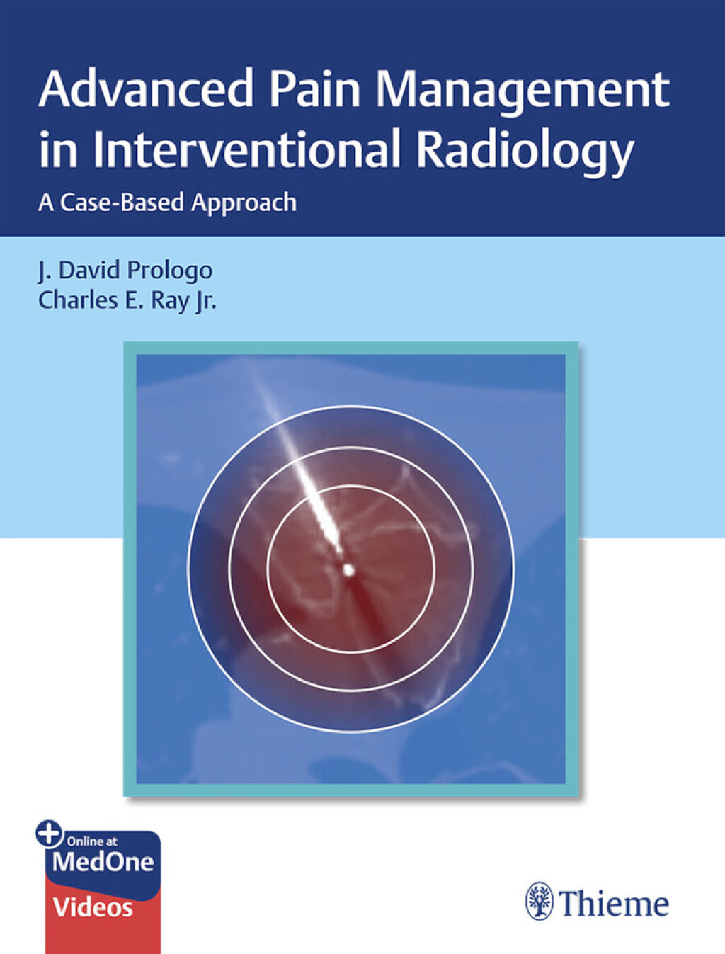 Advanced Pain Management in Interventional Radiology A Case-Based Approach 1st Edition