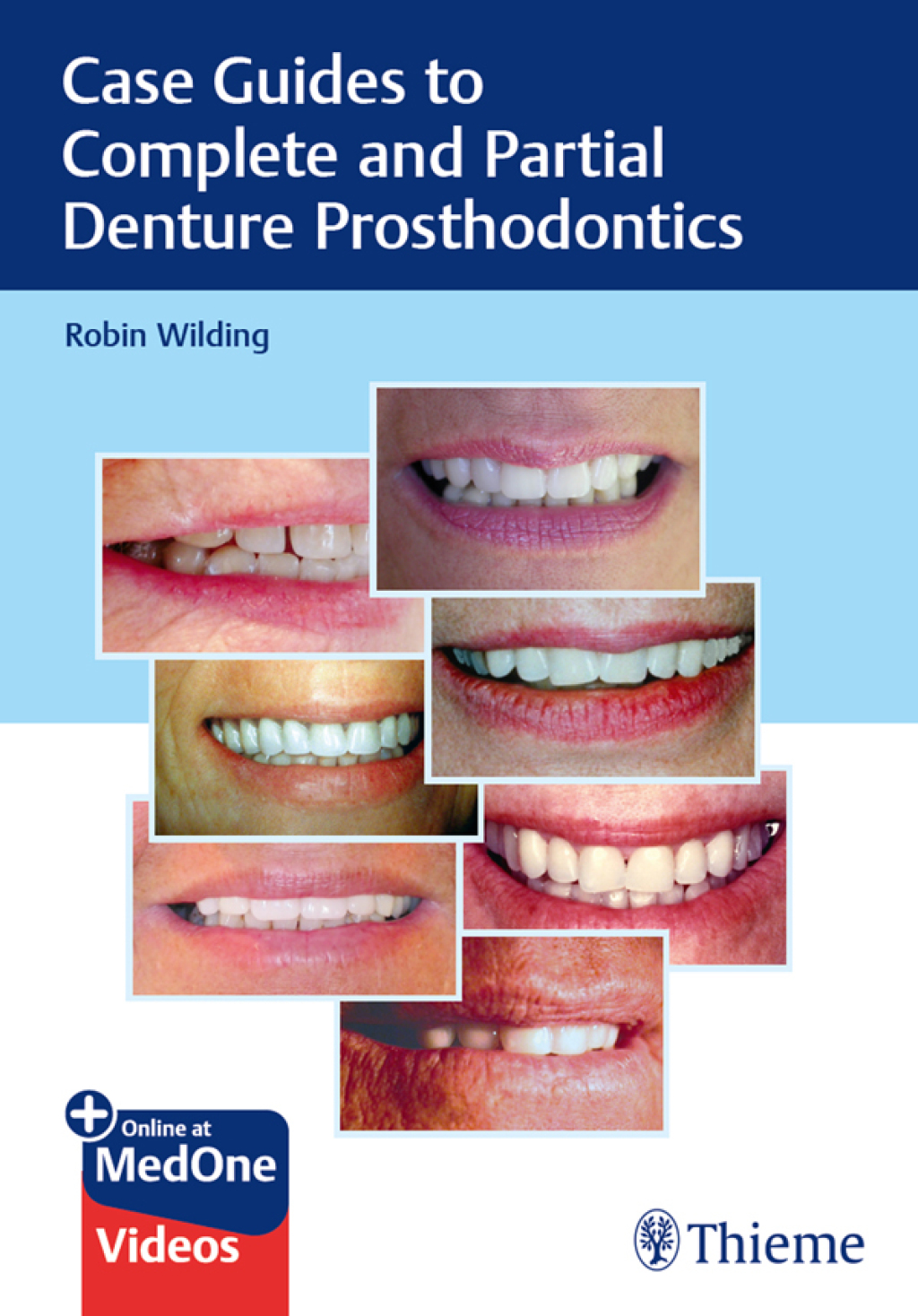 Case Guides to Complete and Partial Denture Prosthodontics 1st Edition