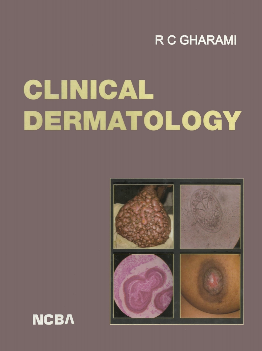 Clinical Dermatology 