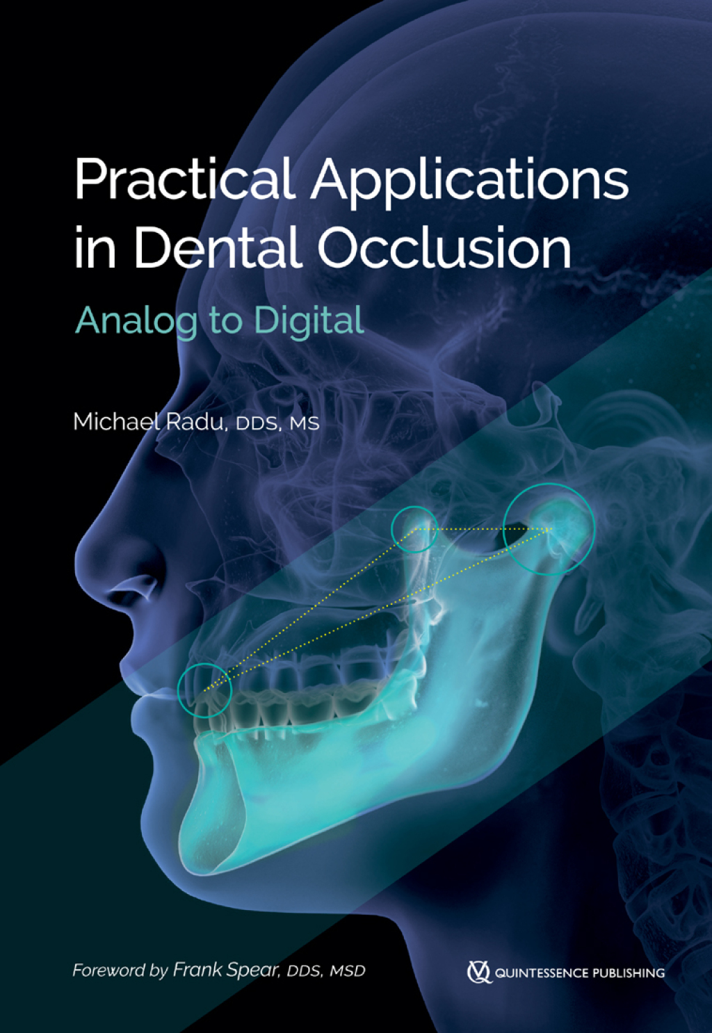 Practical Applications in Dental Occlusion: Analog to Digital 1st Edition