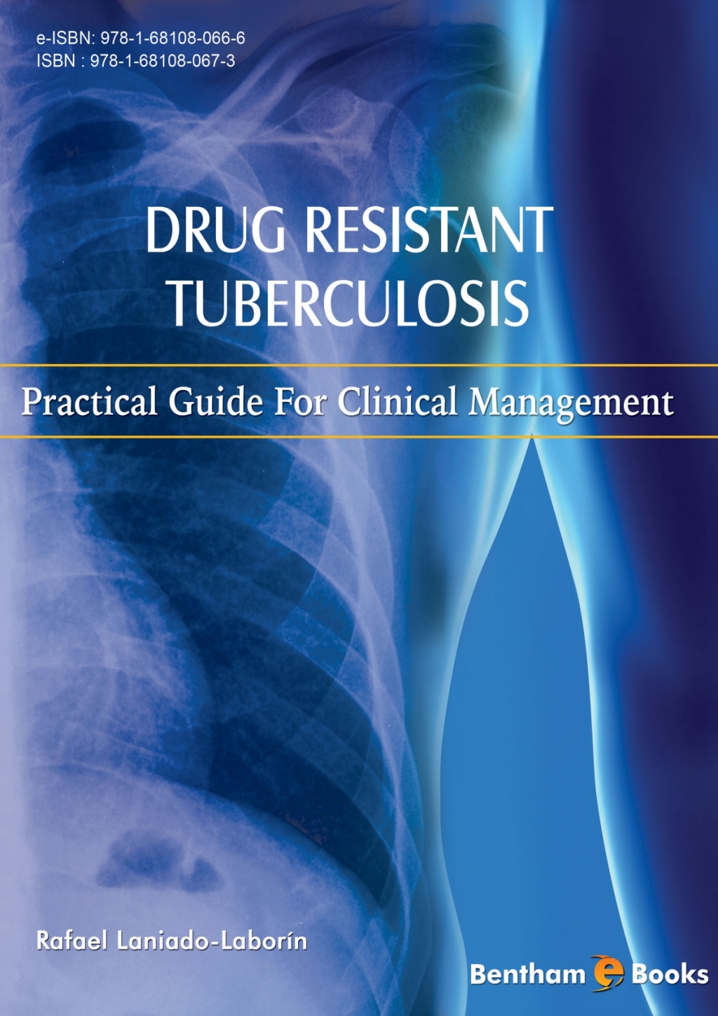 Drug Resistant Tuberculosis: Practical guide for clinical management 1st Edition