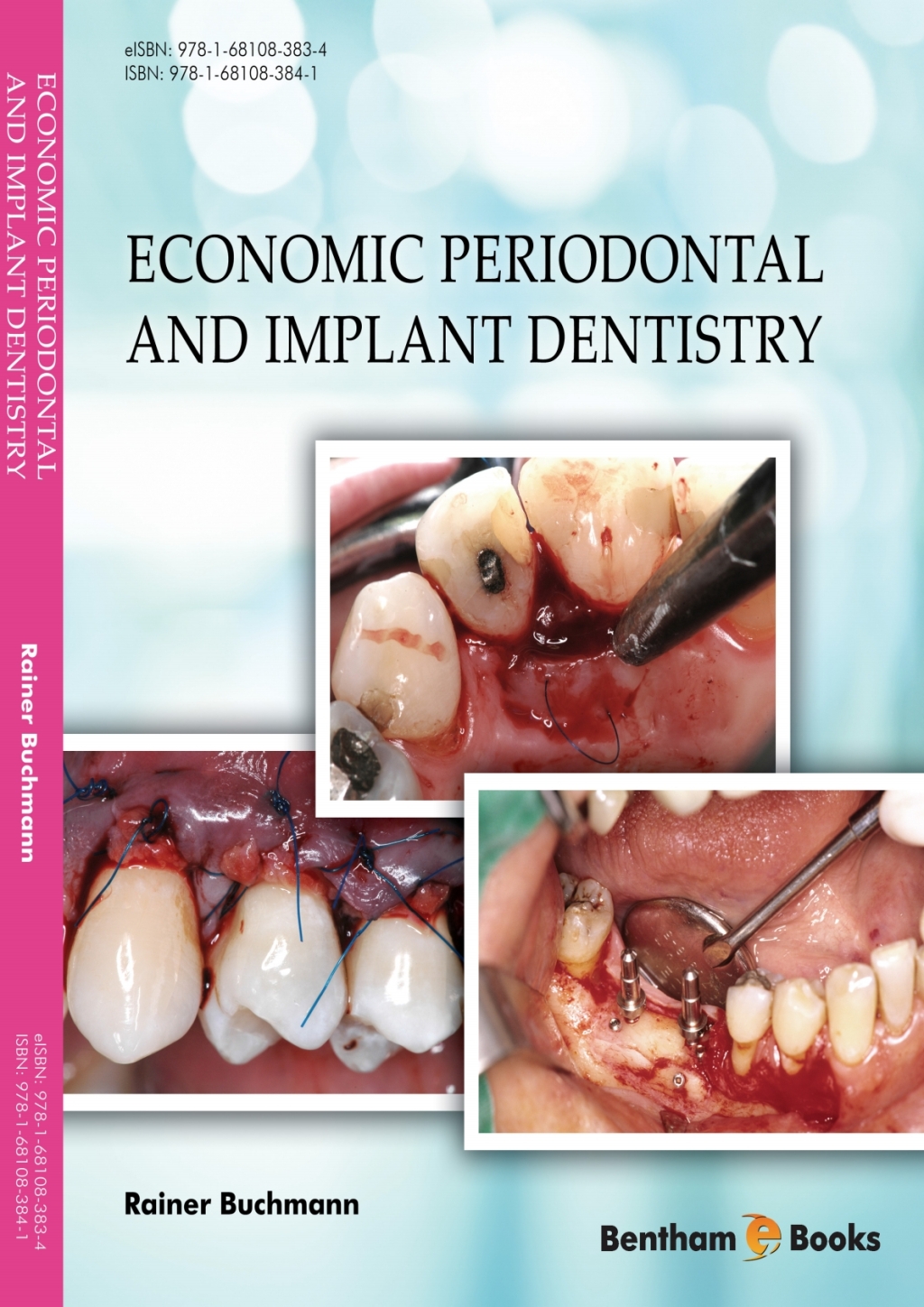 Economic Periodontal and Implant Dentistry 1st Edition