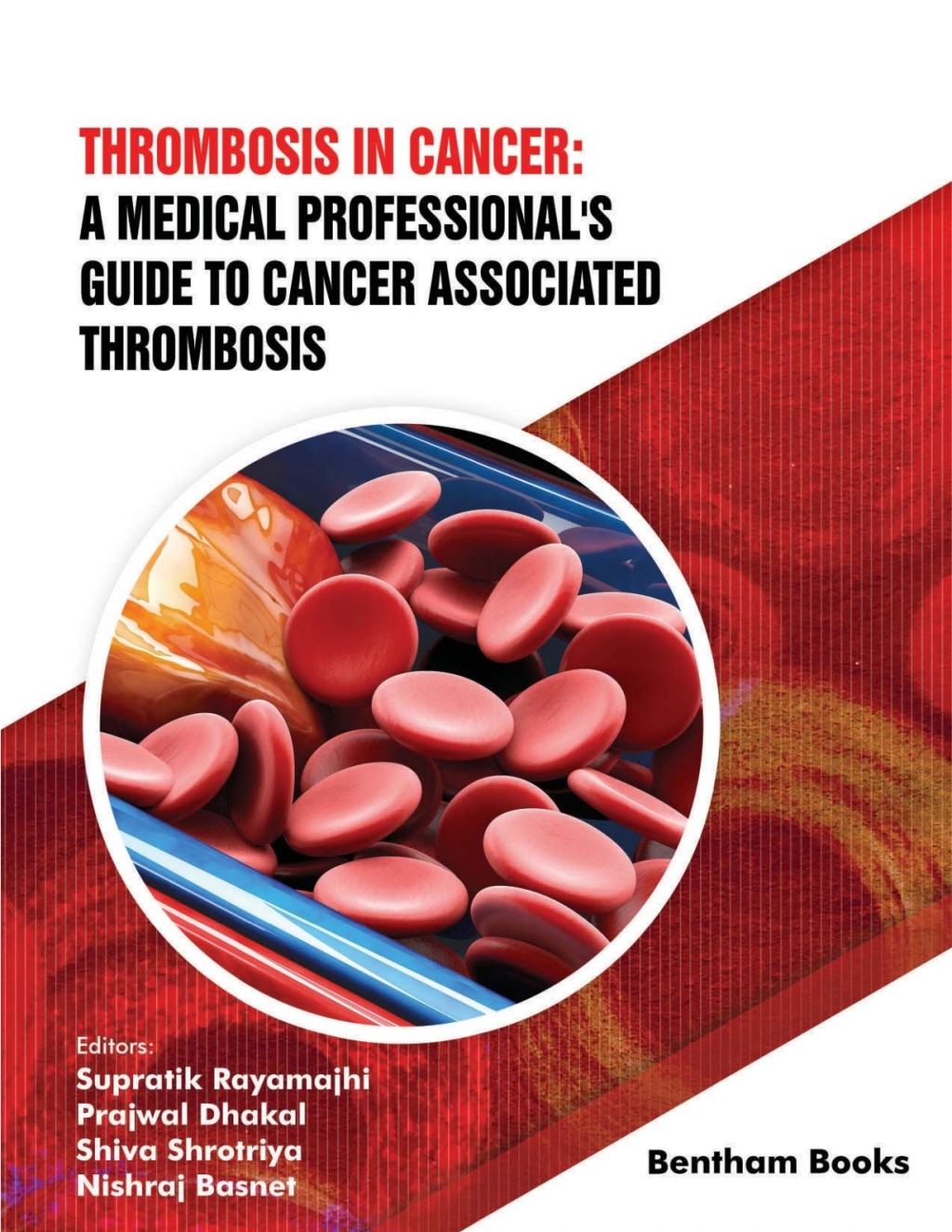 Thrombosis in Cancer: A Medical Professional's Guide to Cancer Associated Thrombosis 1st Edition