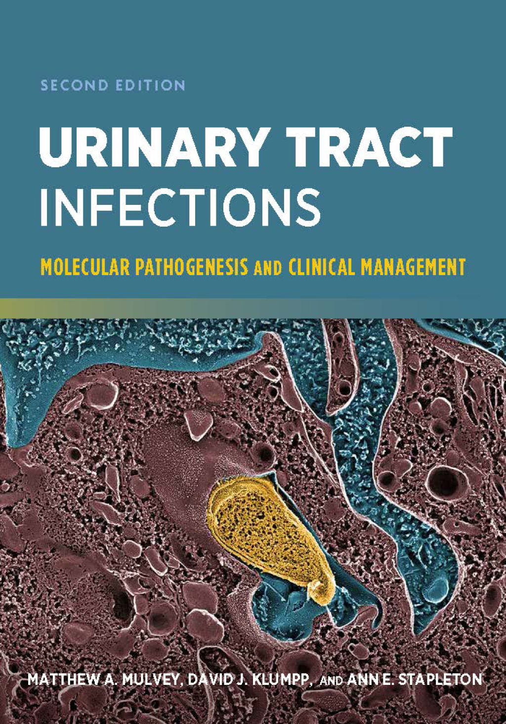 Urinary Tract Infections Molecular Pathogenesis and Clinical Management 2nd Edition