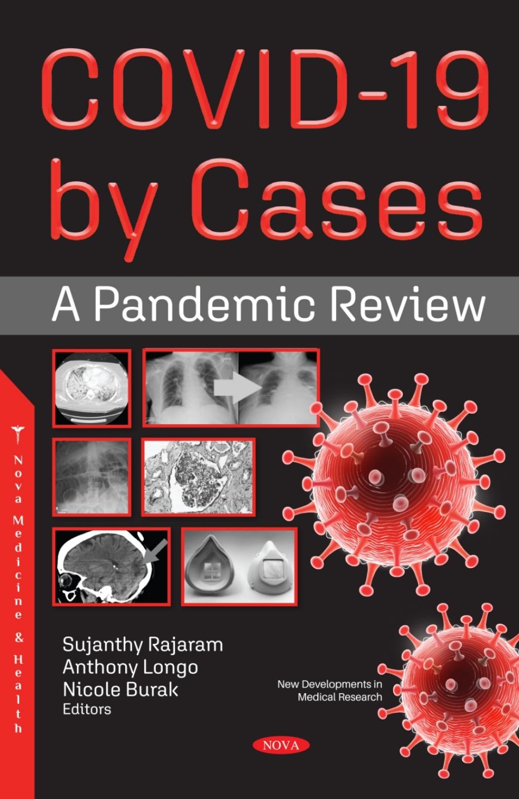 COVID-19 by Cases: A Pandemic Review 