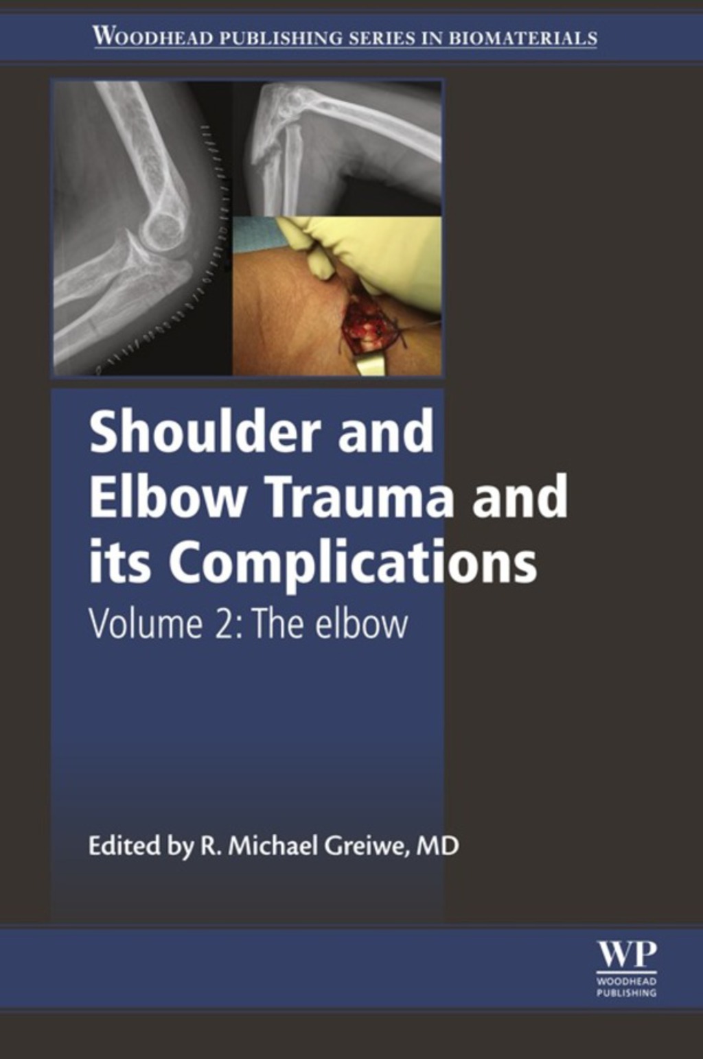 Shoulder and Elbow Trauma and its Complications: The Elbow 