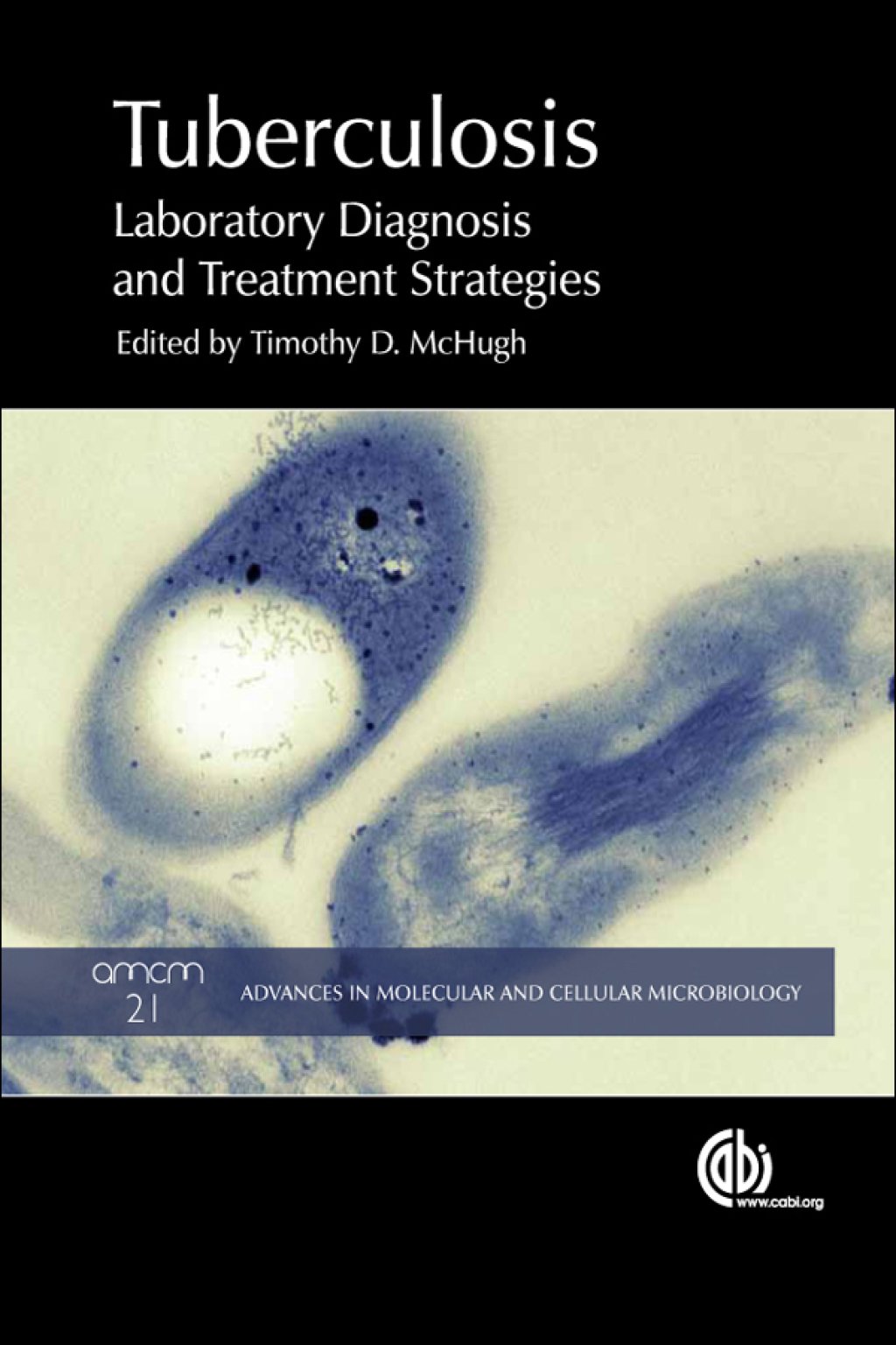 Tuberculosis Laboratory Diagnosis and Treatment Strategies 1st Edition