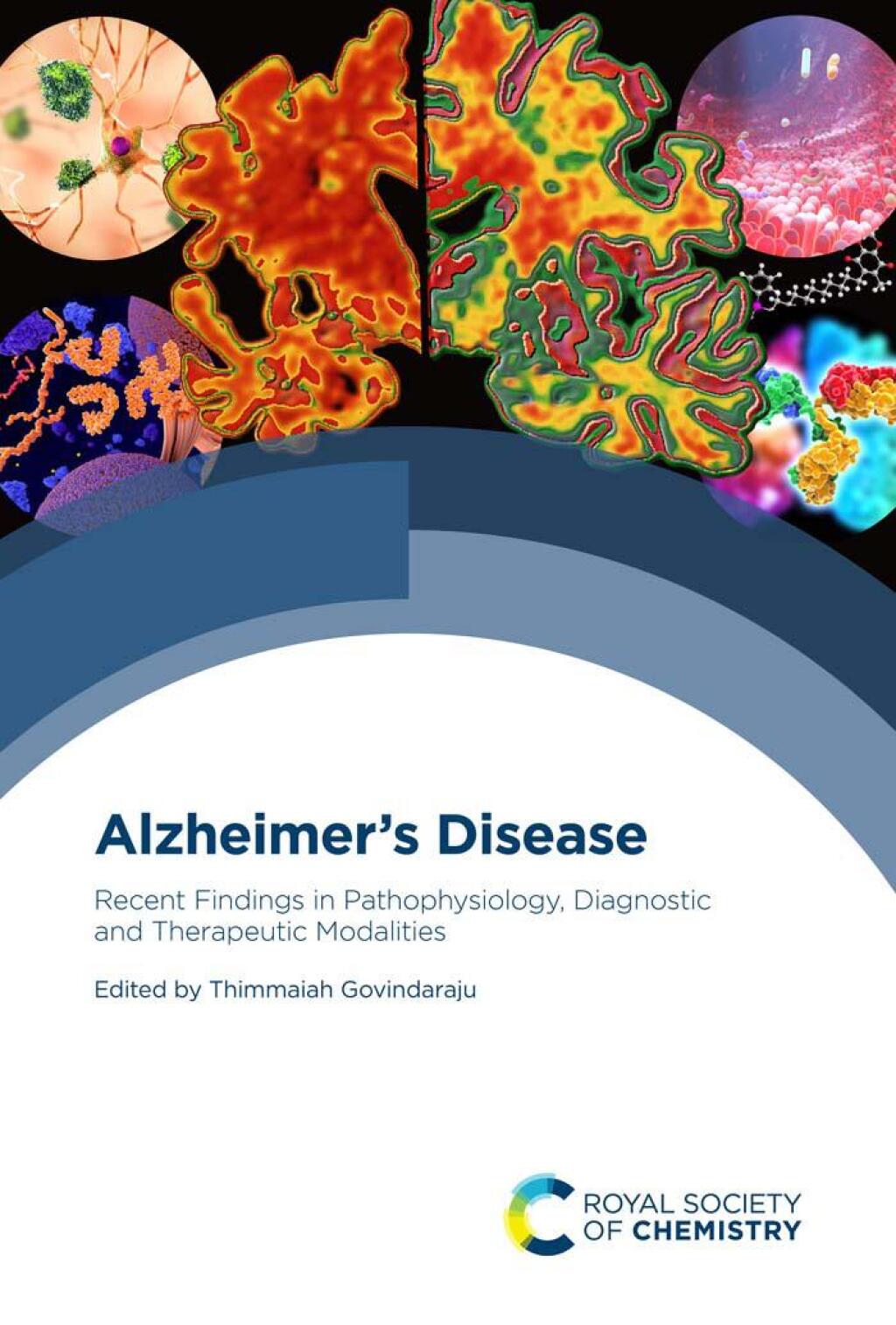 Alzheimer's Disease Recent Findings in Pathophysiology, Diagnostic and Therapeutic Modalities 1st Edition