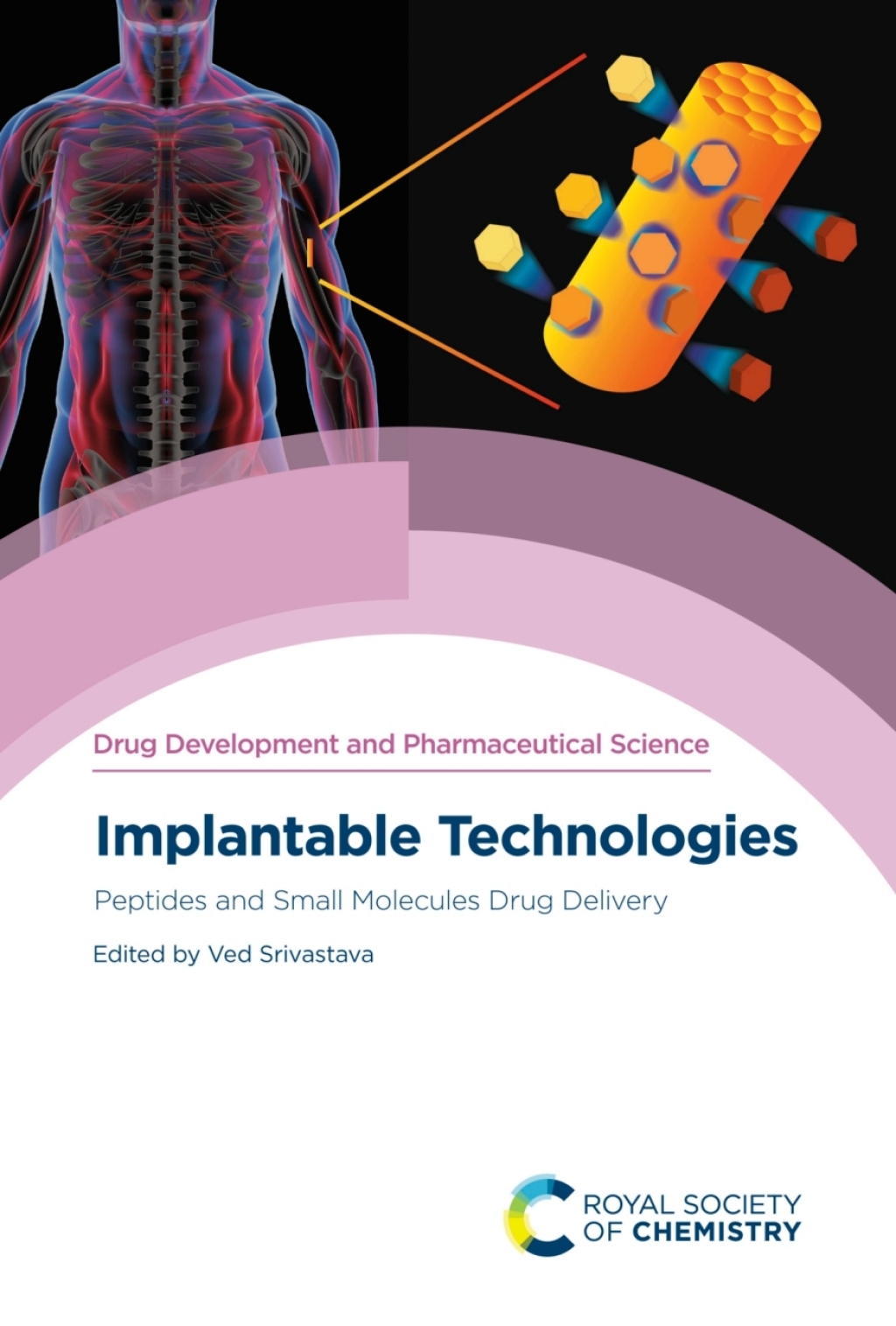 Implantable Technologies Peptides and Small Molecules Drug Delivery 1st Edition