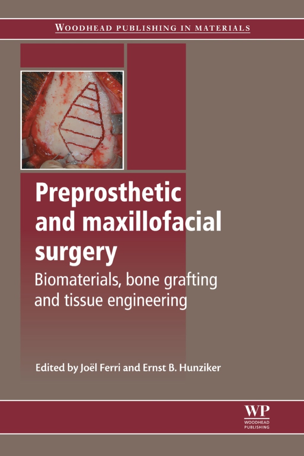 Preprosthetic and Maxillofacial Surgery: Biomaterials, Bone Grafting and Tissue Engineering 